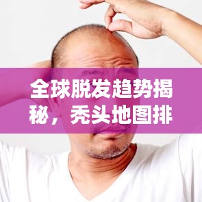 全球脱发趋势揭秘，秃头地图排名及惊人数据解析