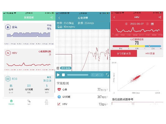 手环app官方下载与新版本血魔,实地数据验证设计&尊贵版_v8.285